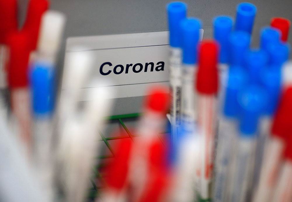 U Sloveniji 2428 novozaraženih, svaki treći test pozitivan, mjere ostaju iste